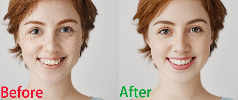 How to Remove Freckles from Photos