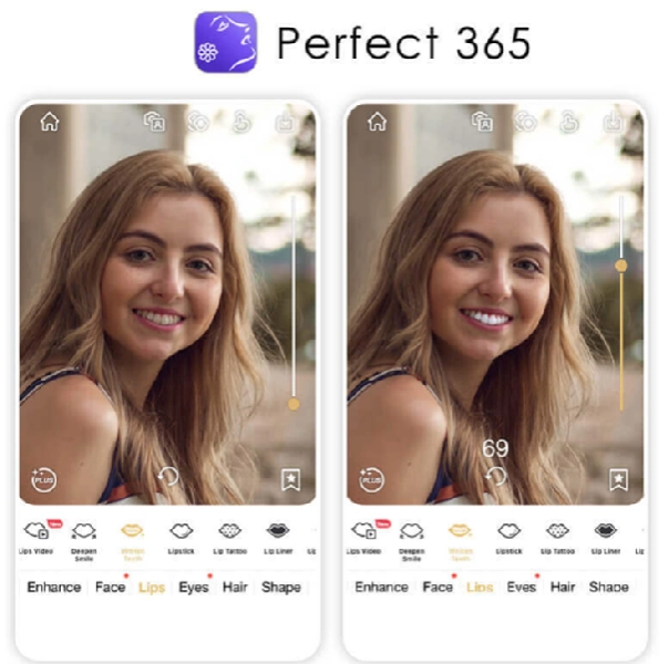 Perfect 365 Image Teeth Whitening