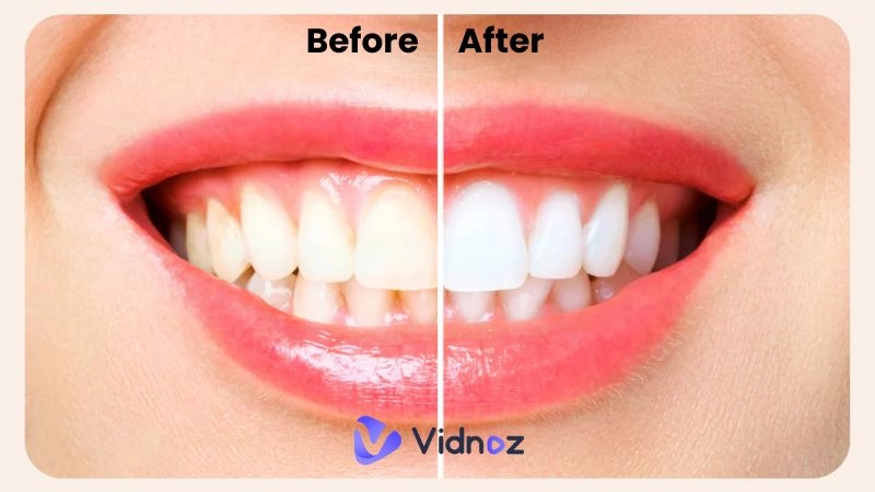 13 Best Teeth Whitening Apps for Radiant Smiles in 2025